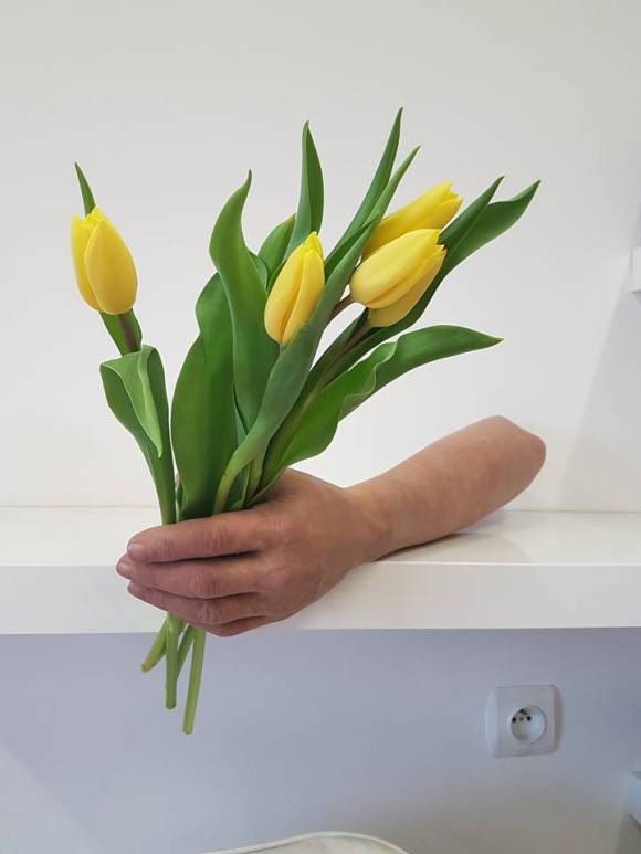 kwiaty, tulipany, dłoń, proteza estetyczna ręki, proteza kosmetyczna ręki, Proteza kosmetyczna palców, Protetica, Łódź, Zagajnikowa 35, poradnia protetyczna